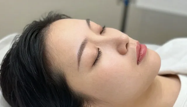 面部年轻化综合治疗中的安全操作关键